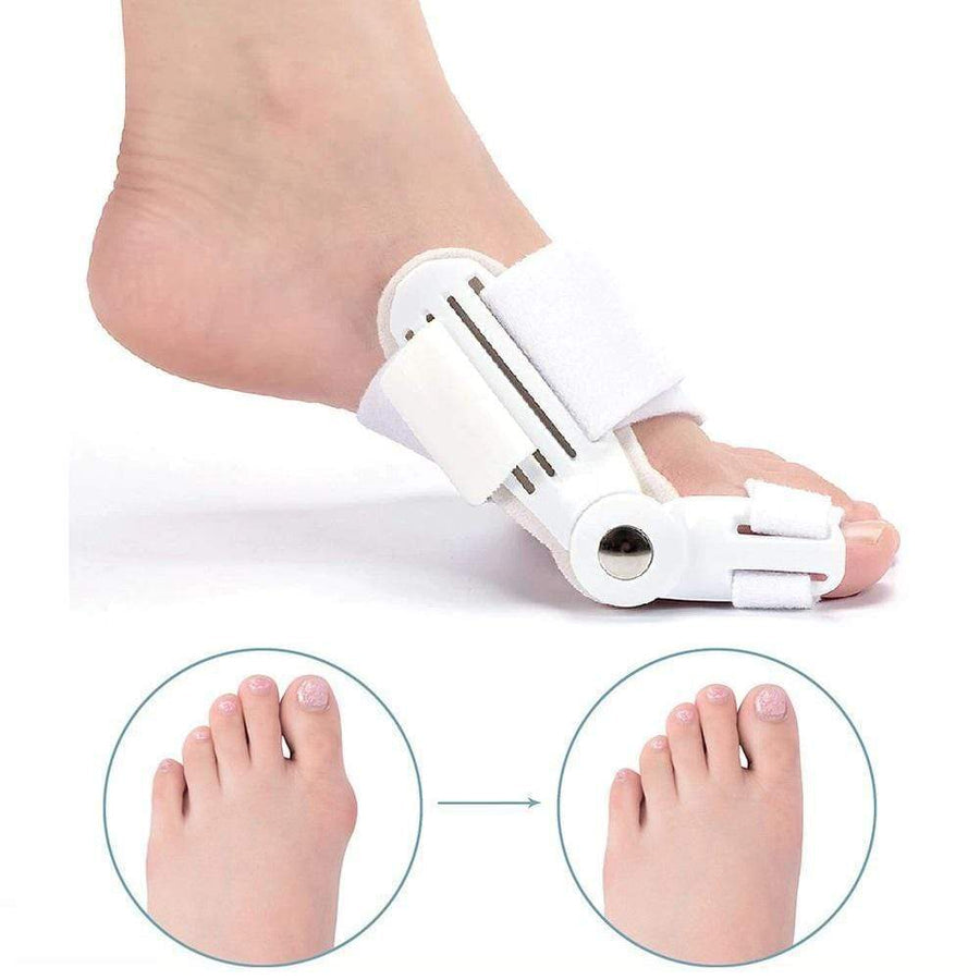 OrthoCorrect Zehenstütze – Korrigierende Hallux Valgus Lösung