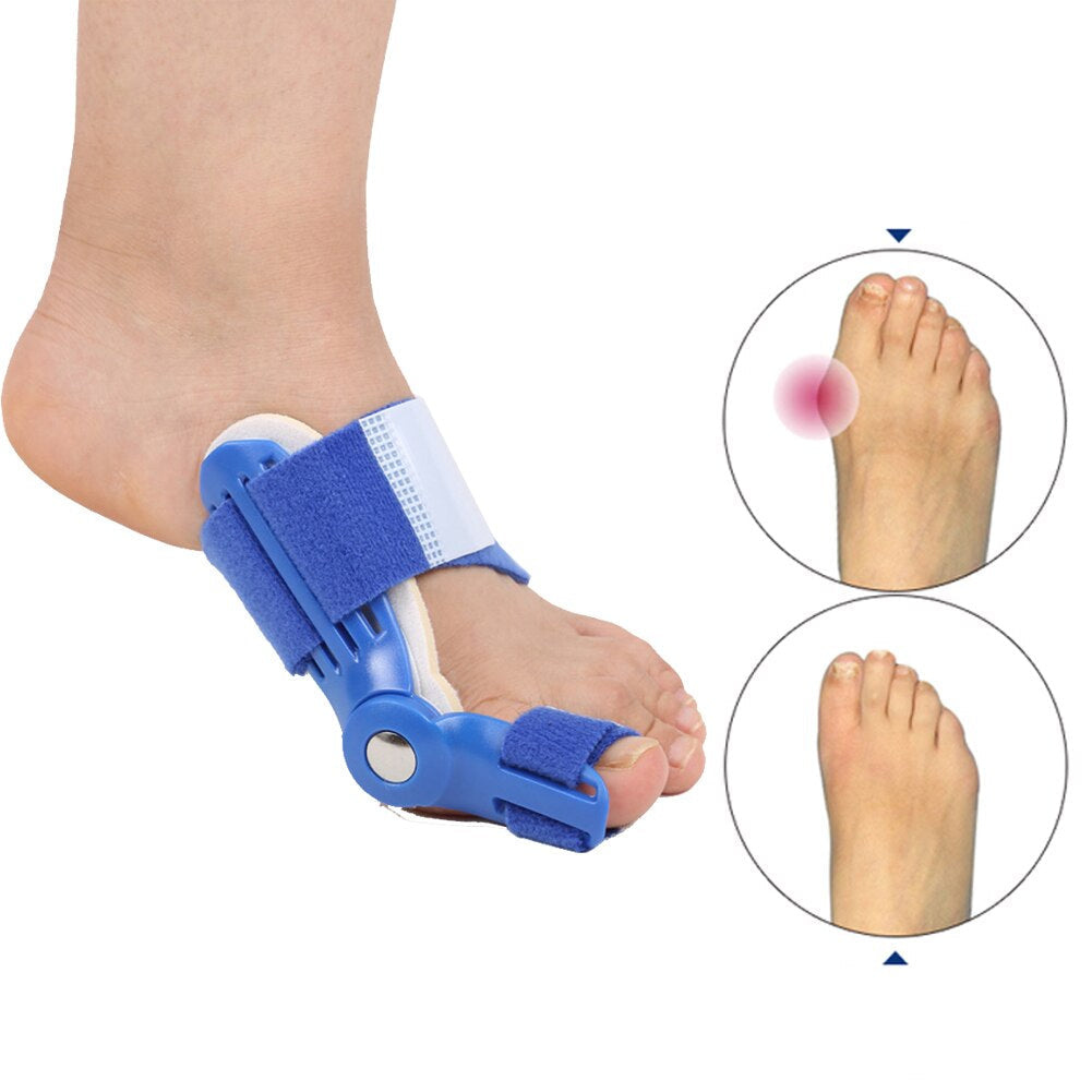 OrthoCorrect Zehenstütze – Korrigierende Hallux Valgus Lösung