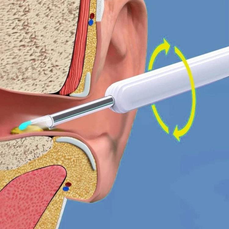 ClearView Ohrreiniger – Schlank, Sicher und Hygienisch