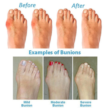 Orthopädische Sandalen für Damen - Komfort und Unterstützung bei jedem Schritt