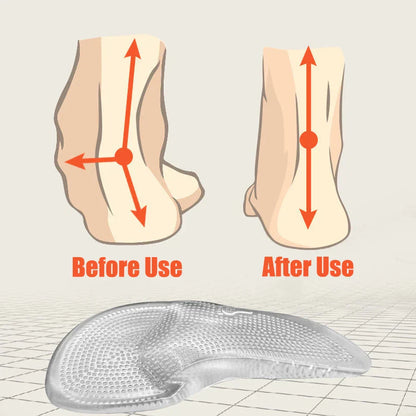 Silicone-Gel-Orthopädische Einlagen – Fußgewölbeunterstützung & Komfort
